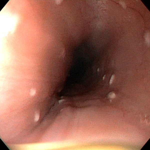 Endoscopic Image